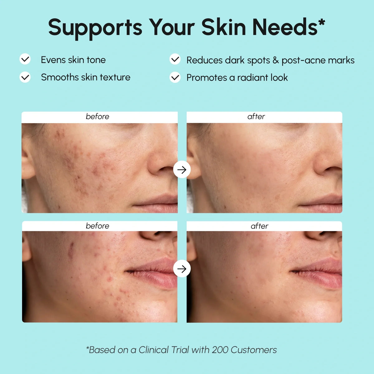 Azelaic Acid Cream for Sensitive Skin by Maree — product image 3