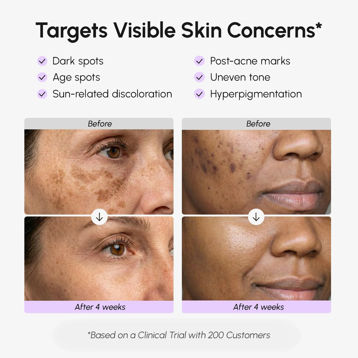 Face & Body Serum for Dark Spots by Maree — product image 3