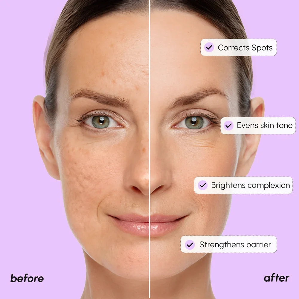 Dark Spot Corrector by Maree — product image 4