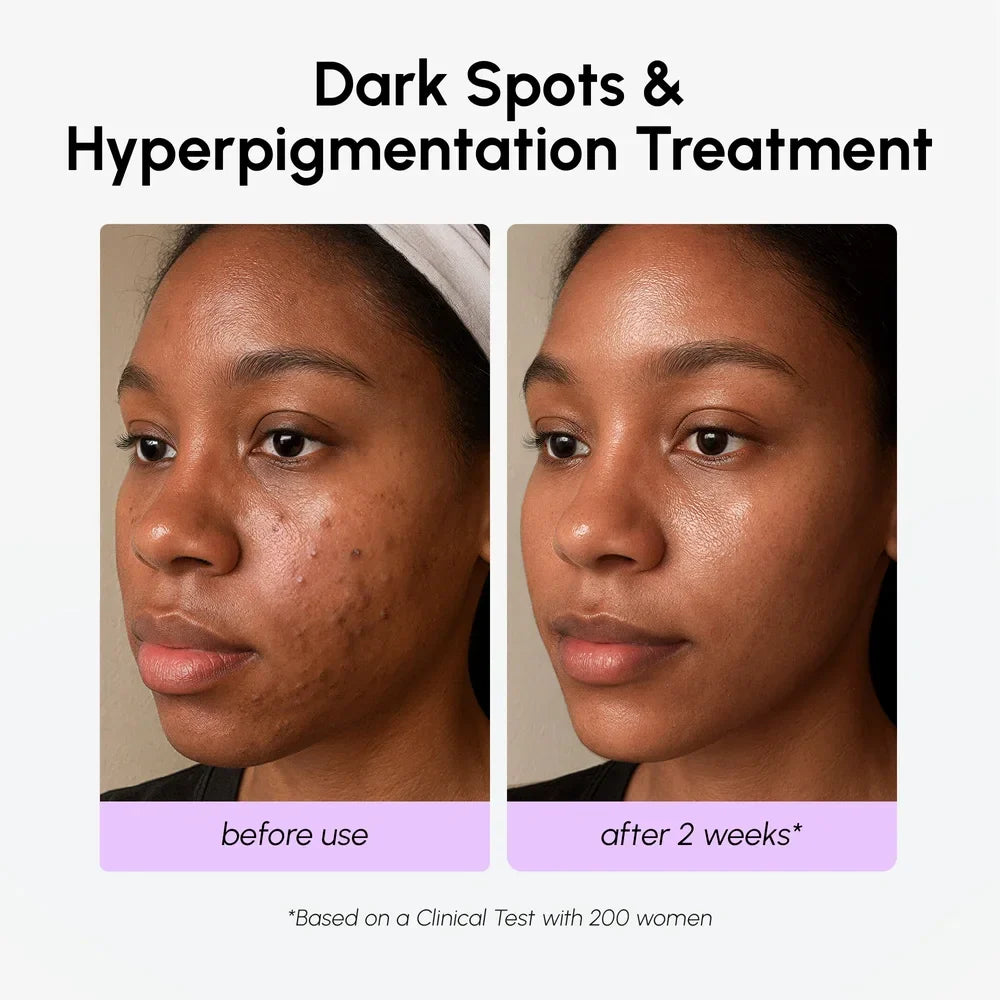 Dark Spot Corrector by Maree — product image 5